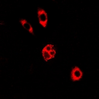 GALE / UDP-Glucose 4-Epimerase Antibody - Immunofluorescent analysis of GALE staining in A549 cells. Formalin-fixed cells were permeabilized with 0.1% Triton X-100 in TBS for 5-10 minutes and blocked with 3% BSA-PBS for 30 minutes at room temperature. Cells were probed with the primary antibody in 3% BSA-PBS and incubated overnight at 4 deg C in a humidified chamber. Cells were washed with PBST and incubated with a DyLight 594-conjugated secondary antibody (red) in PBS at room temperature in the dark.