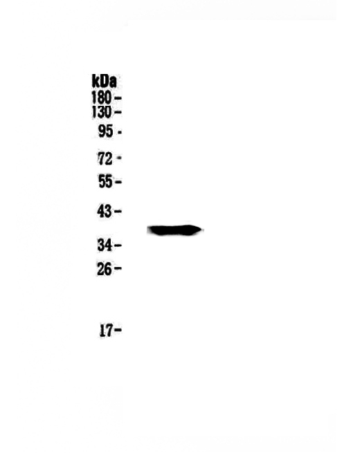 GALE / UDP-Glucose 4-Epimerase Antibody - Western blot - Anti-GALE Picoband antibody