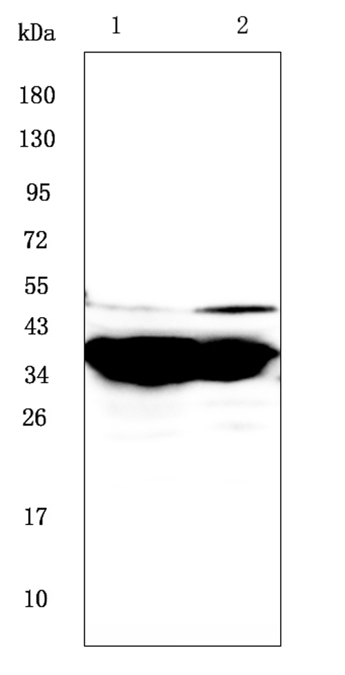 GALE / UDP-Glucose 4-Epimerase Antibody - Western blot analysis of GALE using anti-GALE antibody. Electrophoresis was performed on a 5-20% SDS-PAGE gel at 70V (Stacking gel) / 90V (Resolving gel) for 2-3 hours. The sample well of each lane was loaded with 50ug of sample under reducing conditions. Lane 1: mouse small intestine tissue lysates, Lane 2: mouse stomach tissue lysates. After Electrophoresis, proteins were transferred to a Nitrocellulose membrane at 150mA for 50-90 minutes. Blocked the membrane with 5% Non-fat Milk/ TBS for 1.5 hour at RT. The membrane was incubated with rabbit anti-GALE antigen affinity purified polyclonal antibody at 0.5 µg/mL overnight at 4°C, then washed with TBS-0.1% Tween 3 times with 5 minutes each and probed with a goat anti-rabbit IgG-HRP secondary antibody at a dilution of 1:10000 for 1.5 hour at RT. The signal is developed using an Enhanced Chemiluminescent detection (ECL) kit with Tanon 5200 system. A specific band was detected for GALE at approximately 38KD. The expected band size for GALE is at 38KD.