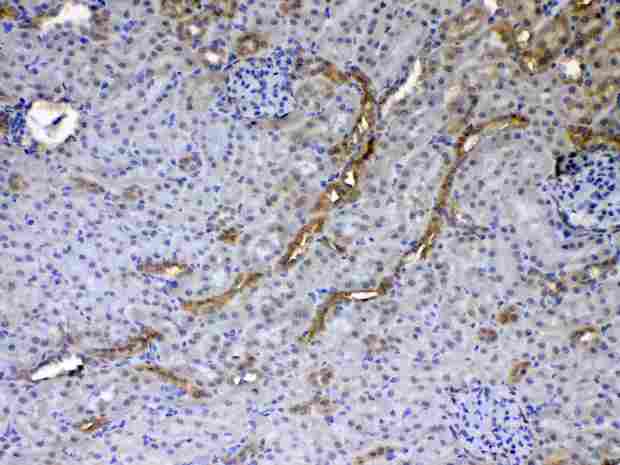 GALE / UDP-Glucose 4-Epimerase Antibody - IHC analysis of GALE using anti-GALE antibody. GALE was detected in paraffin-embedded section of rat kidney tissue. Heat mediated antigen retrieval was performed in citrate buffer (pH6, epitope retrieval solution) for 20 mins. The tissue section was blocked with 10% goat serum. The tissue section was then incubated with 1µg/ml rabbit anti-GALE Antibody overnight at 4°C. Biotinylated goat anti-rabbit IgG was used as secondary antibody and incubated for 30 minutes at 37°C. The tissue section was developed using Strepavidin-Biotin-Complex (SABC) with DAB as the chromogen.