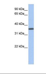 GALE / UDP-Glucose 4-Epimerase Antibody - Fetal liver lysate. Antibody concentration: 1.0 ug/ml. Gel concentration: 12%.  This image was taken for the unconjugated form of this product. Other forms have not been tested.