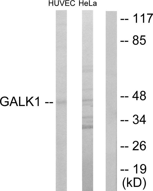GALK1 / GK1 Antibody - Western blot analysis of lysates from HUVEC and HeLa cells, using GALK1 Antibody. The lane on the right is blocked with the synthesized peptide.