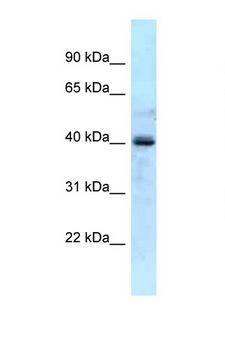 GALK1 / GK1 Antibody - GALK1 antibody Western blot of Fetal Liver lysate. Antibody concentration 1 ug/ml.  This image was taken for the unconjugated form of this product. Other forms have not been tested.