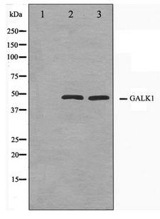 GALK1 / GK1 Antibody - Western blot of NIH-3T3 and HeLa cell lysate using GALK1 Antibody
