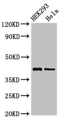 GALK1 / GK1 Antibody - Western Blot Positive WB detected in:HEK293 whole cell lysate,Hela whole cell lysate All Lanes:GALK1 antibody at 3µg/ml Secondary Goat polyclonal to rabbit IgG at 1/50000 dilution Predicted band size: 43,46 KDa Observed band size: 43 KDa