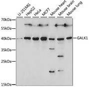 GALK1 / GK1 Antibody - Western blot analysis of extracts of various cell lines, using GALK1 antibody at 1:1000 dilution. The secondary antibody used was an HRP Goat Anti-Rabbit IgG (H+L) at 1:10000 dilution. Lysates were loaded 25ug per lane and 3% nonfat dry milk in TBST was used for blocking. An ECL Kit was used for detection and the exposure time was 60S.