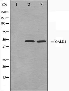 GALK1 / GK1 Antibody - Western blot analysis on NIH-3T3 and HeLa cell lysates using GALK1 antibody. The lane on the left is treated with the antigen-specific peptide.