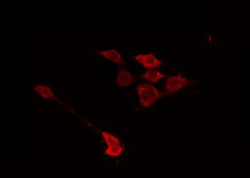 GALK1 / GK1 Antibody - Staining HuvEc cells by IF/ICC. The samples were fixed with PFA and permeabilized in 0.1% Triton X-100, then blocked in 10% serum for 45 min at 25°C. The primary antibody was diluted at 1:200 and incubated with the sample for 1 hour at 37°C. An Alexa Fluor 594 conjugated goat anti-rabbit IgG (H+L) Ab, diluted at 1/600, was used as the secondary antibody.