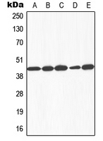 GALK1 / GK1 Antibody - Western blot analysis of Galactose Kinase expression in HEK293T (A); HepG2 (B); SP2/0 (C); rat liver (D); Human liver (E) whole cell lysates.