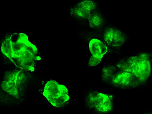 GALK1 / GK1 Antibody - Immunofluorescence staining of HG3C-GALK1 in MCF7 cells. Cells were fixed with 4% PFA, permeabilzed with 0.3% Triton X-100 in PBS, blocked with 10% serum, and incubated with rabbit anti- HG3C-GALK1 polyclonal antibody (dilution ratio: 1:1000) at 4°C overnight. Then cells were stained with the Alexa Fluor 488-conjugated Goat Anti-rabbit IgG secondary antibody (green). Positive staining was localized to cytoplasm.
