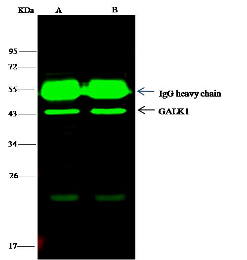 GALK1 / GK1 Antibody - GALK1 was immunoprecipitated using: Lane A: 0.5 mg Hela Whole Cell Lysate. Lane B: 0.5 mg HepG2 Whole Cell Lysate. 4 uL anti-GALK1 rabbit polyclonal antibody and 15 ul of 50% Protein G agarose. Primary antibody: Anti-GALK1 rabbit polyclonal antibody, at 1:100 dilution. Secondary antibody: Dylight 800-labeled antibody to rabbit IgG (H+L), at 1:5000 dilution. Developed using the odssey technique. Performed under reducing conditions. Predicted band size: 42 kDa. Observed band size: 42 kDa.