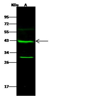 GALK1 / GK1 Antibody - Anti-GALK1 rabbit polyclonal antibody at 1:500 dilution. Lane A: HeLa Whole Cell Lysate. Lysates/proteins at 30 ug per lane. Secondary: Goat Anti-Rabbit IgG H&L (Dylight 800) at 1/10000 dilution. Developed using the Odyssey technique. Performed under reducing conditions. Predicted band size: 42 kDa. Observed band size: 42 kDa. (We are unsure as to the identity of these extra bands.)