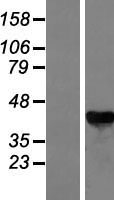 GALK1 / GK1 Protein - Western validation with an anti-DDK antibody * L: Control HEK293 lysate R: Over-expression lysate