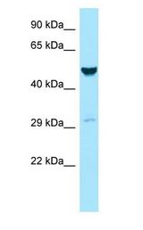 GALK2 Antibody - GALK2 antibody Western Blot of MCF7.  This image was taken for the unconjugated form of this product. Other forms have not been tested.