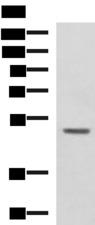 GALK2 Antibody - Western blot analysis of 293T cell lysate  using GALK2 Polyclonal Antibody at dilution of 1:1350