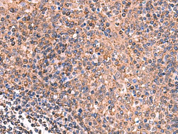 GALK2 Antibody - Immunohistochemistry of paraffin-embedded Human tonsil tissue  using GALK2 Polyclonal Antibody at dilution of 1:160(×200)