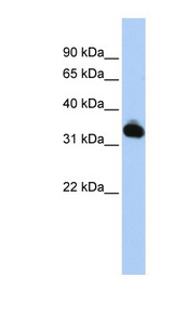 GALM / Mutarotase Antibody - GALM antibody Western blot of HepG2 cell lysate. This image was taken for the unconjugated form of this product. Other forms have not been tested.