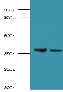 GALM / Mutarotase Antibody - Western blot of Aldose 1-epimerase antibody at 2 ug/ml lane 1: mouse kidney tissue lane 2: rat adrenal gland tissue secondary Goat polyclonal to rabbit at 1:10000 dilution predicted band size: 38 KDa observed band size: 38 KDa.  This image was taken for the unconjugated form of this product. Other forms have not been tested.