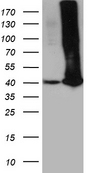 GALM / Mutarotase Antibody - HEK293T cells were transfected with the pCMV6-ENTRY control. (Left lane) or pCMV6-ENTRY GALM. (Right lane) cDNA for 48 hrs and lysed