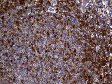 GALM / Mutarotase Antibody - Immunohistochemical staining of paraffin-embedded Human tonsil within the normal limits using anti-GALM mouse monoclonal antibody. (Heat-induced epitope retrieval by 1mM EDTA in 10mM Tris buffer. (pH8.5) at 120°C for 3 min. (1:2000)