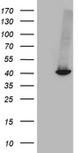 GALM / Mutarotase Antibody - HEK293T cells were transfected with the pCMV6-ENTRY control. (Left lane) or pCMV6-ENTRY GALM. (Right lane) cDNA for 48 hrs and lysed