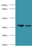 GALM / Mutarotase Antibody - Western blot of Aldose 1-epimerase antibody at 2 ug/ml lane 1: mouse kidney tissue lane 2: rat adrenal gland tissue secondary Goat polyclonal to rabbit at 1:10000 dilution predicted band size: 38 KDa observed band size: 38 KDa.  This image was taken for the unconjugated form of this product. Other forms have not been tested.