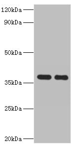 GALM / Mutarotase Antibody - Western blot All lanes: GALM antibody at 2µg/ml Lane 1: Mouse kidney tissue Lane 2: Rat adrenal gland tissue Secondary Goat polyclonal to rabbit IgG at 1/10000 dilution Predicted band size: 38 kDa Observed band size: 38 kDa