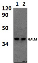 GALM / Mutarotase Antibody - Western blot of GALM antibody at 1:1000 dilution. Lane 1: HEPG2 whole cell lysate (56.4ug). Lane 2: LO2 whole cell lysate (52.8ug).