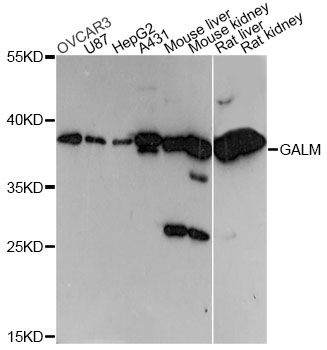 GALM / Mutarotase Antibody - Western blot analysis of extracts of various cell lines, using GALM antibody at 1:3000 dilution. The secondary antibody used was an HRP Goat Anti-Rabbit IgG (H+L) at 1:10000 dilution. Lysates were loaded 25ug per lane and 3% nonfat dry milk in TBST was used for blocking. An ECL Kit was used for detection and the exposure time was 30s.