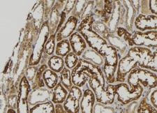 GALM / Mutarotase Antibody - 1:100 staining mouse kidney tissue by IHC-P. The sample was formaldehyde fixed and a heat mediated antigen retrieval step in citrate buffer was performed. The sample was then blocked and incubated with the antibody for 1.5 hours at 22°C. An HRP conjugated goat anti-rabbit antibody was used as the secondary.