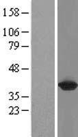 GALM / Mutarotase Protein - Western validation with an anti-DDK antibody * L: Control HEK293 lysate R: Over-expression lysate