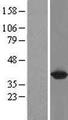 GALM / Mutarotase Protein - Western validation with an anti-DDK antibody * L: Control HEK293 lysate R: Over-expression lysate