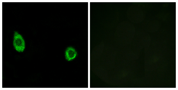 GALNAC4ST-2 / CHST9 Antibody - Immunofluorescence analysis of HUVEC cells, using CHST9 Antibody. The picture on the right is blocked with the synthesized peptide.