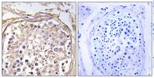 GALNAC4ST-2 / CHST9 Antibody - Immunohistochemistry analysis of paraffin-embedded human testis tissue, using CHST9 Antibody. The picture on the right is blocked with the synthesized peptide.