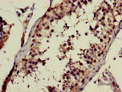GALNAC4ST-2 / CHST9 Antibody - Immunohistochemistry image of paraffin-embedded human testis tissue at a dilution of 1:100