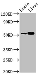 GALNAC4ST-2 / CHST9 Antibody - Positive Western Blot detected in Mouse brain tissue, Mouse liver tissue. All lanes: CHST9 antibody at 2.8 µg/ml Secondary Goat polyclonal to rabbit IgG at 1/50000 dilution. Predicted band size: 53 KDa. Observed band size: 53 KDa
