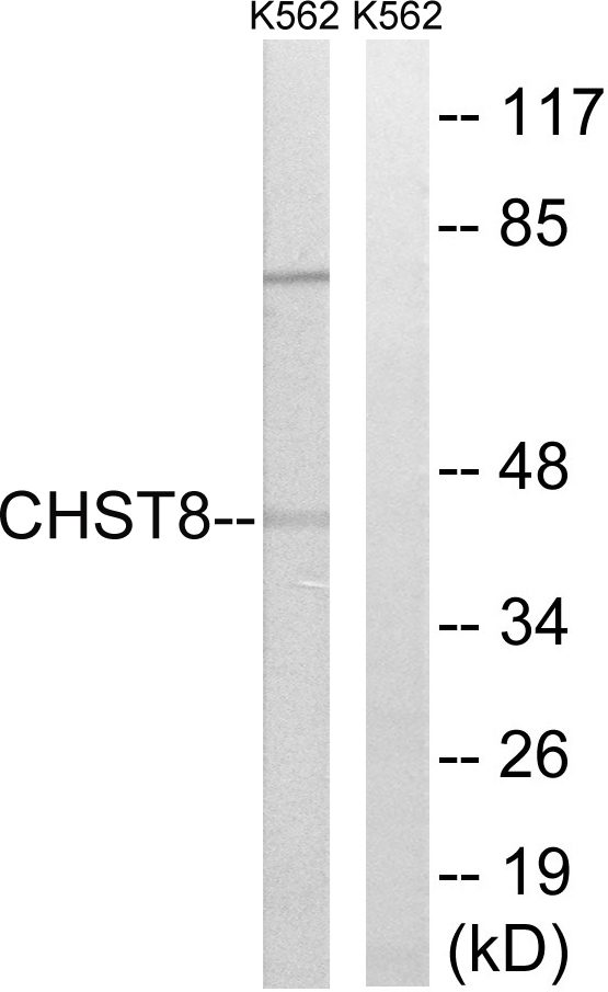 GALNAC4ST1 / CHST8 Antibody - Western blot analysis of lysates from K562 cells, using CHST8 Antibody. The lane on the right is blocked with the synthesized peptide.