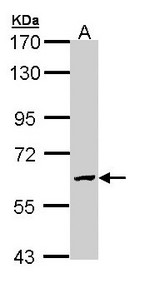 GALNS / Chondroitinase Antibody - Sample (30 ug of whole cell lysate). A: H1299. 7.5% SDS PAGE. GALNS / Chondroitinase antibody diluted at 1:1000