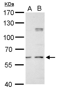 GALNS / Chondroitinase Antibody - GALNS antibody detects GALNS protein by Western blot analysis. A. 30 ug PC-12 whole cell lysate/extract. B. 30 ug Rat2 whole cell lysate/extract. 7.5 % SDS-PAGE. GALNS antibody dilution:1:500