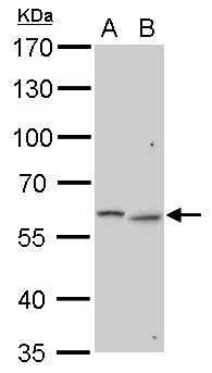 GALNS / Chondroitinase Antibody - GALNS antibody detects GALNS protein by Western blot analysis. A. 30 ug Neuro2A whole cell lysate/extract. B. 30 ug C2C12 whole cell lysate/extract. 7.5 % SDS-PAGE. GALNS antibody dilution:1:1000