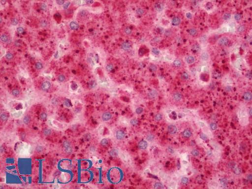 GALNS / Chondroitinase Antibody - Human Liver: Formalin-Fixed, Paraffin-Embedded (FFPE).  This image was taken for the unconjugated form of this product. Other forms have not been tested.