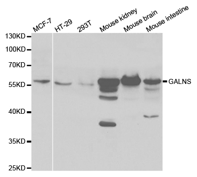 GALNS / Chondroitinase Antibody - Western blot analysis of extracts of various cell lines.