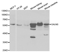 GALNS / Chondroitinase Antibody - Western blot analysis of extracts of various cell lines.