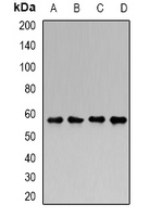 GALNS / Chondroitinase Antibody - Western blot analysis of Chondroitinase expression in MCF7 (A); HT29 (B); mouse kidney (C); mouse brain (D) whole cell lysates.