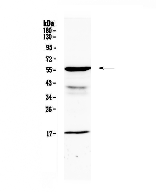 GALNS / Chondroitinase Antibody - Western blot - Anti-GALNS Picoband antibody
