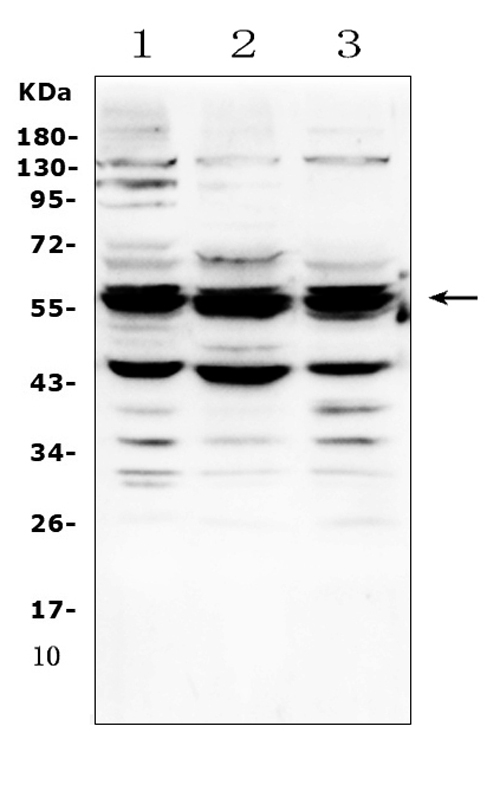 GALNS / Chondroitinase Antibody - Western blot analysis of GALNS using anti-GALNS antibody. Electrophoresis was performed on a 5-20% SDS-PAGE gel at 70V (Stacking gel) / 90V (Resolving gel) for 2-3 hours. The sample well of each lane was loaded with 50ug of sample under reducing conditions. Lane 1: human Hela whole cell lysates, Lane 2: human MCF-7 whole cell lysates, Lane 3: human COLO-320 whole cell lysates. After Electrophoresis, proteins were transferred to a Nitrocellulose membrane at 150mA for 50-90 minutes. Blocked the membrane with 5% Non-fat Milk/ TBS for 1.5 hour at RT. The membrane was incubated with rabbit anti-GALNS antigen affinity purified polyclonal antibody at 0.5 µg/mL overnight at 4°C, then washed with TBS-0.1% Tween 3 times with 5 minutes each and probed with a goat anti-rabbit IgG-HRP secondary antibody at a dilution of 1:10000 for 1.5 hour at RT. The signal is developed using an Enhanced Chemiluminescent detection (ECL) kit with Tanon 5200 system. A specific band was detected for GALNS at approximately 58KD. The expected band size for GALNS is at 58KD.