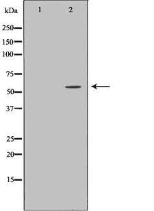 GALNS / Chondroitinase Antibody - Western blot analysis of HeLa whole cells lysates using GALNS antibody. The lane on the left is treated with the antigen-specific peptide.