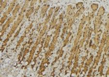 GALNS / Chondroitinase Antibody - 1:100 staining human gastric tissue by IHC-P. The sample was formaldehyde fixed and a heat mediated antigen retrieval step in citrate buffer was performed. The sample was then blocked and incubated with the antibody for 1.5 hours at 22°C. An HRP conjugated goat anti-rabbit antibody was used as the secondary.