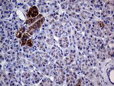 GALNT10 Antibody - Immunohistochemical staining of paraffin-embedded Human pancreas tissue within the normal limits using anti-GALNT10 mouse monoclonal antibody. (Heat-induced epitope retrieval by 1mM EDTA in 10mM Tris buffer. (pH8.5) at 120°C for 3 min. (1:500)