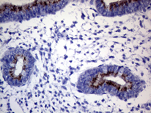 GALNT10 Antibody - Immunohistochemical staining of paraffin-embedded Human endometrium tissue within the normal limits using anti-GALNT10 mouse monoclonal antibody. (Heat-induced epitope retrieval by 1mM EDTA in 10mM Tris buffer. (pH8.5) at 120°C for 3 min. (1:500)